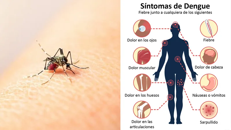 Dengue: cómo diferenciar a los mosquitos que pueden transmitir la enfermedad